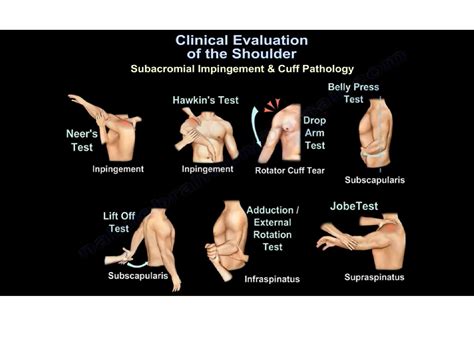 best test to diagnose rotator tear|special tests for shoulder instability.